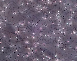 White dots and dark tails of live sperm as seen through a microscope