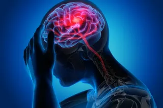 A South Korean team has published a new study that could potentially lead to the treatment of stroke and other neurodegenerative diseases. Photo: Shutterstock