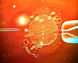 IVF treatment sperm being injected into human egg
