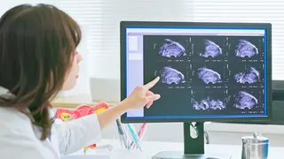 An OBGYN reviewing an ultrasound image of a woman's uterus on a computer screen.