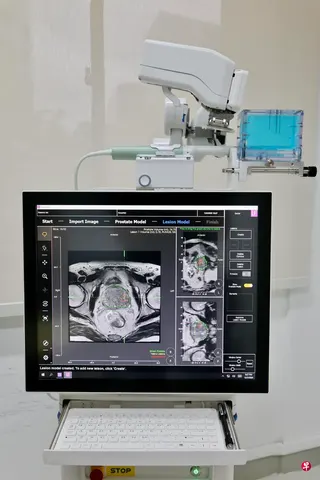 Biobot Surgical作为新加坡首家外科手术机器人企业，已在澳大利亚、中国、欧洲、东南亚，以及美国的医院部署约70台机器人，已协助完成超过3万例手术。 （龙国雄摄）
