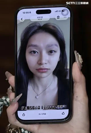 祈錦鈅笑說自己做醫美後臉腫變成食蟻獸。（圖／記者鄭孟晃攝影）