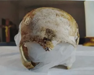 A picture of an 800-year-old skull, believed to be that of Saint Zdislava of Lemberk.