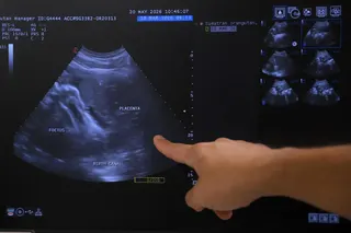 (Embargoed till May 21, 11am) Dr Heng Yirui, Deputy Vice President of veterinary healthcare and scientific programmes at Mandai Wildlife Group, points at a pregnancy ultra sound of Chomel the Orangutan at the Singapore Zoo on May 20, 2026.