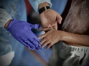 UN reports 125,000 skin infection cases in Gaza linked to rats and parasites