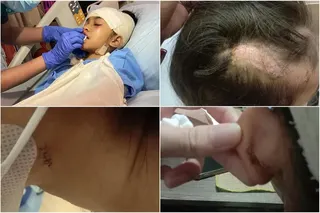 Nurshafira suffered multiple injuries, including a deep wound on her left arm, lacerations on her scalp, chin and ear, and a chipped front tooth.