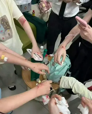 几个女生手臂手腕受伤，一些流血一些瘀青。（互联网）