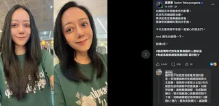 高慧君於近日發文向外界報平安，表示目前右眼狀況仍受先前臉部骨折影響。（圖／翻攝自高慧君FB）