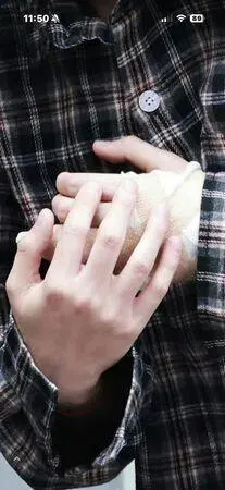 丁程鑫录影时不慎受伤，左手无名指骨裂。（互联网）