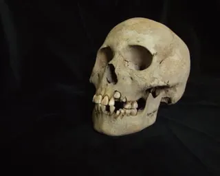 A skull