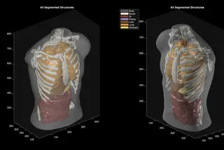ultrasound_phantom_segmentation-b254a71d083eb5c9