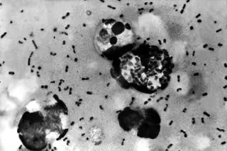 Yersinia pestis, the bacteria responsible for the plague. New DNA analysis reveals the pathogen was causing deadly outbreaks 5,500 years ago. Photo: Shutterstock