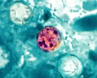 a unicellular parasite