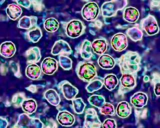 the measles virus